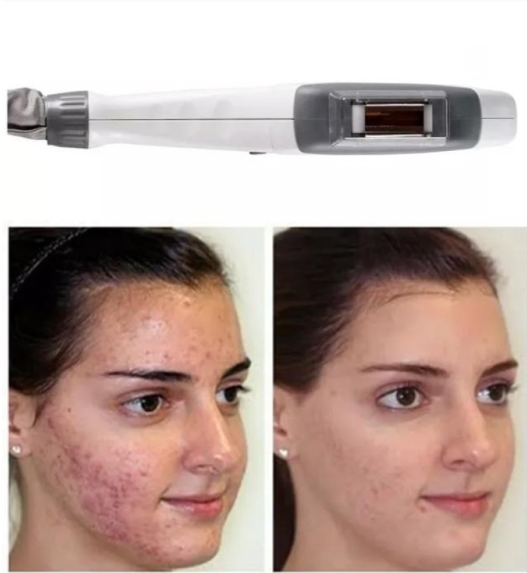 Zemits Light Expert 2.0 IPL Laser na Makina