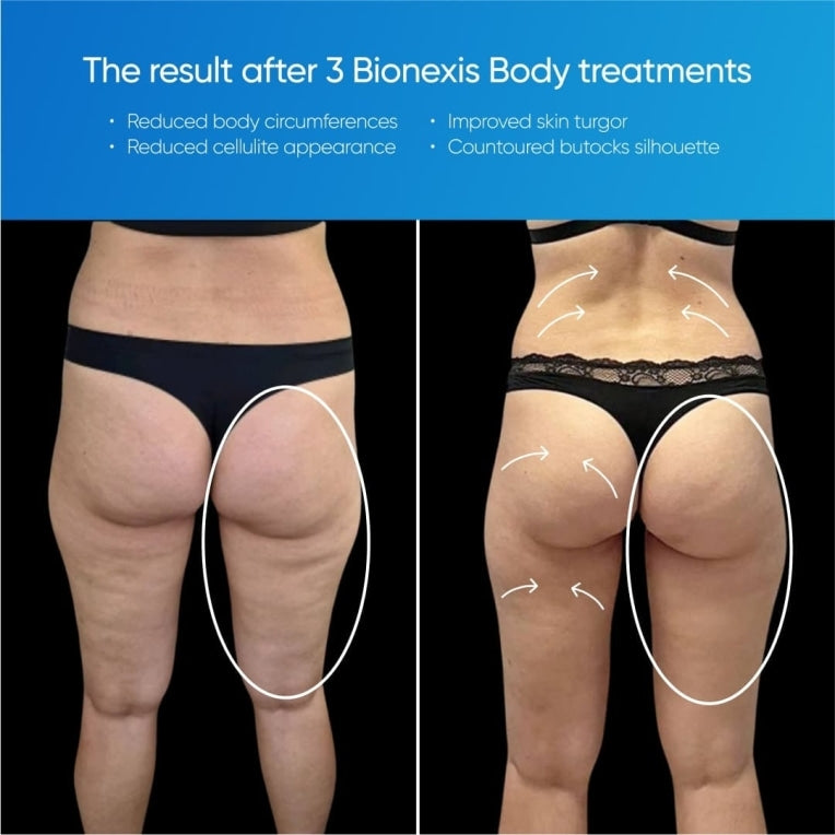 Zemits Bionexis Lite Pro Sistema ng Pagkontur