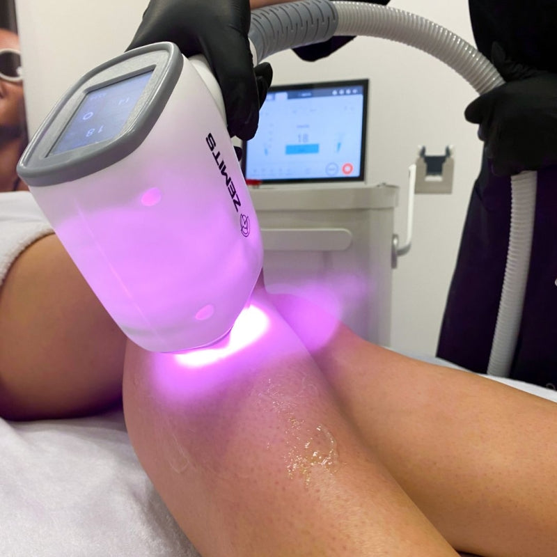 Zemits Quidion Diode Laser Para sa Pag-aalis ng Buhok